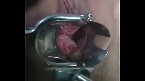 I migliori video squirting with a speculum in my pussy power